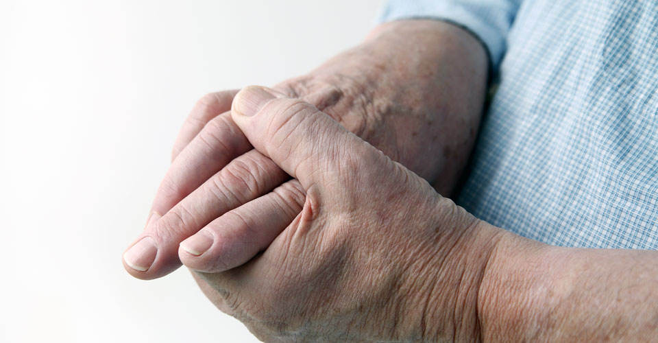 Rheumatoid arthritis case study occupational therapy